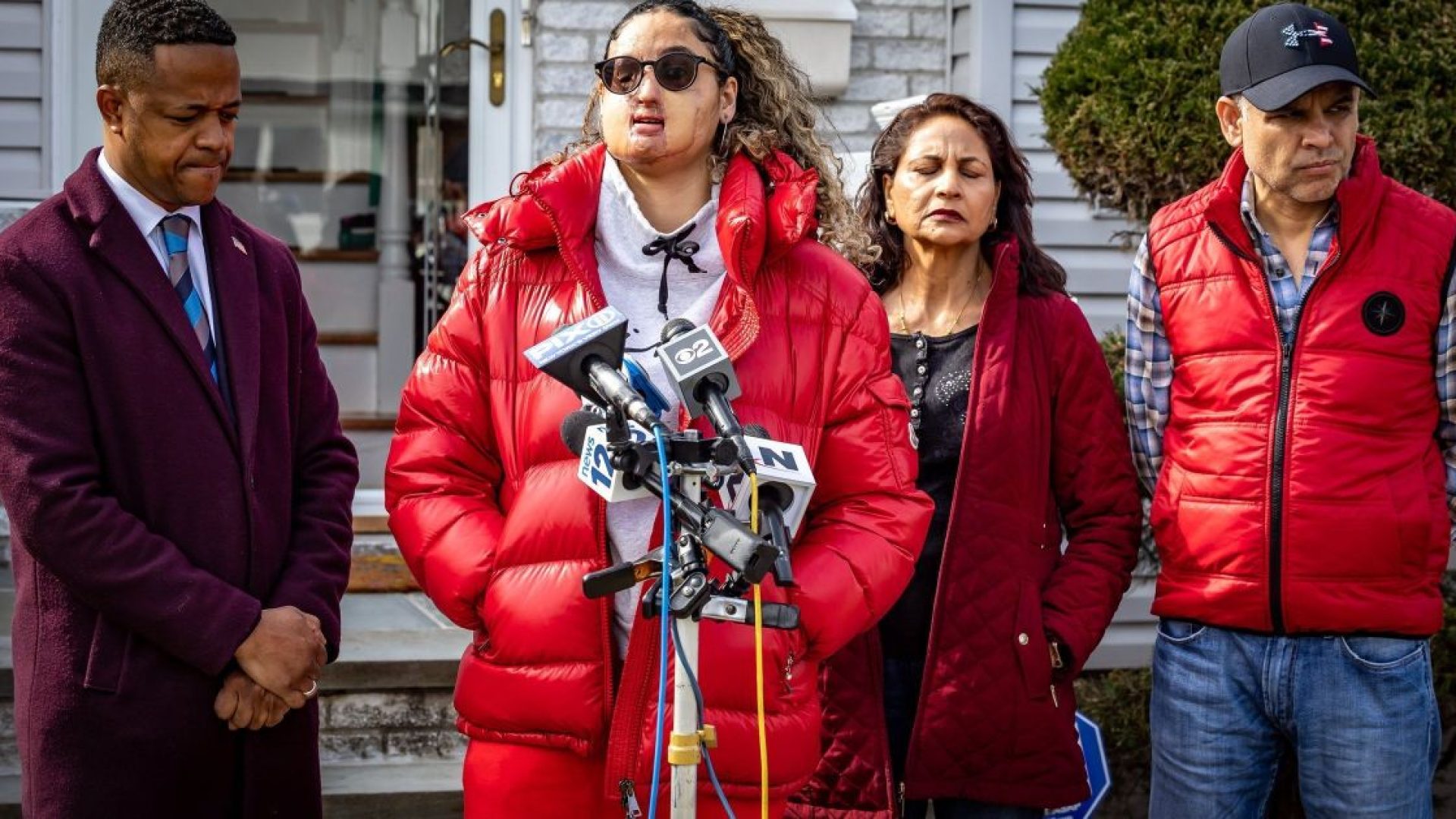Nafiah Ikram, vítima de ataque com ácido em Long Island  • J. Conrad Williams, Jr./Newsday RM via Getty Images