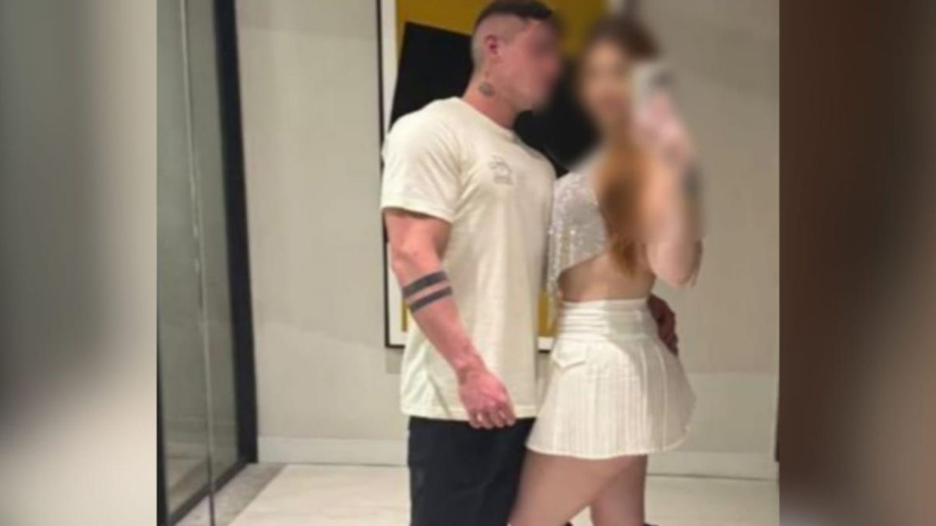 Vítima de fisiculturista teve múltiplas fraturas faciais, mostra laudo